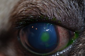 Corneal ulcer (stains green) with perilesional edema (blue)